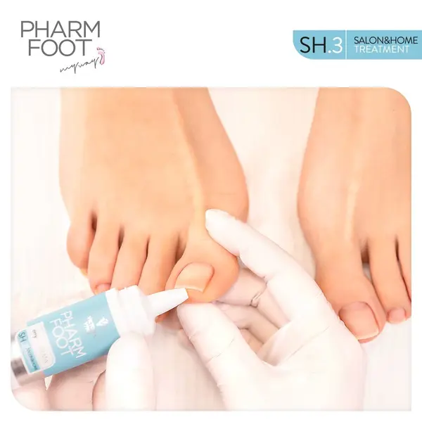 Pharm Foot ONYPLASMA – ONYCHOLYSIS WITH COLOSTRUM 15ML