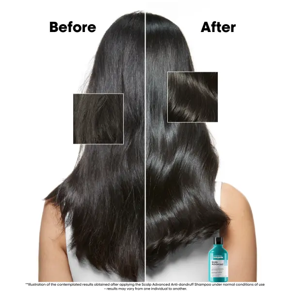 L’Oréal Serie Expert – Scalp Advanced Clarifier Shampoo 300ml