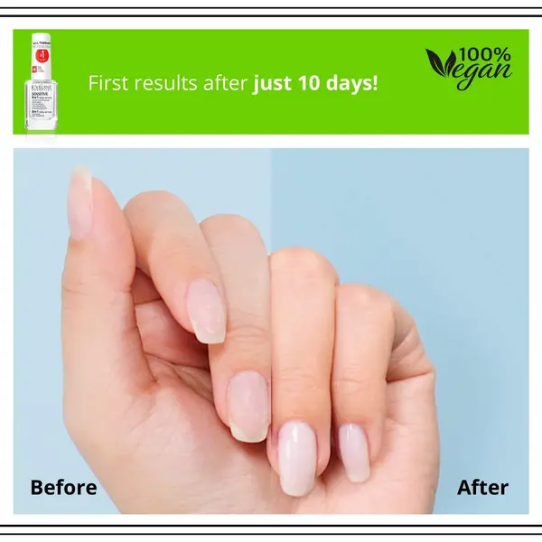 Eveline – 8in1 Total Action Concentrated Conditioner For Sensitive Nails 12ml